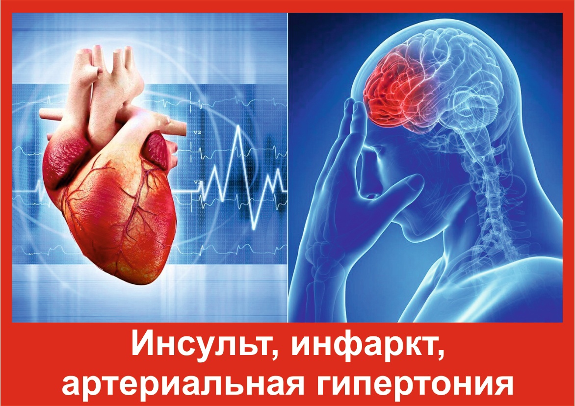 Профилактика инсульта, инфаркта и артериальной гипертонии.
